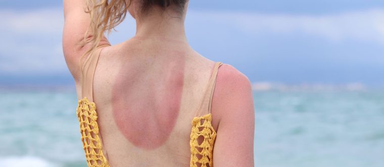 נזקי השמש: כל מה שצריך לדעת על הגנה וטיפוח העור